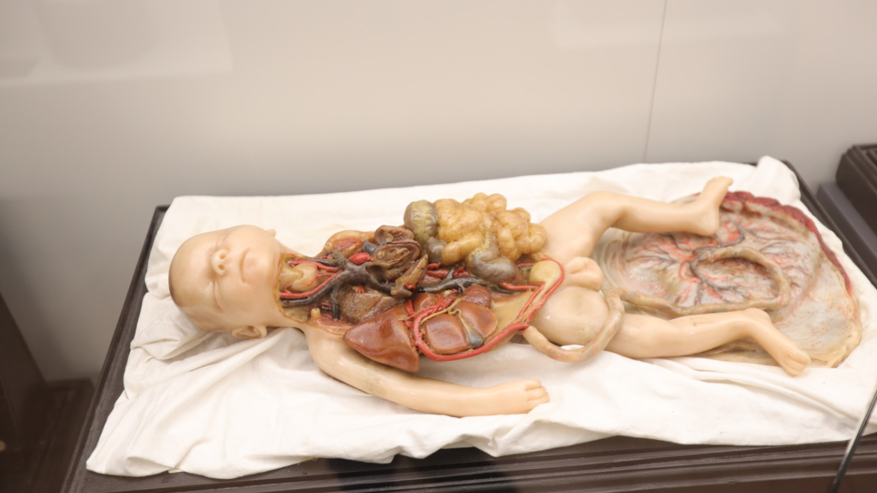 La Facultad de Medicina inaugura una exposición permanente de figuras anatómicas de cera