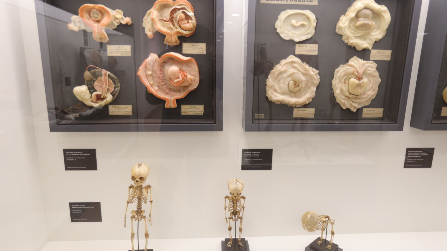 La Facultad de Medicina inaugura una exposición permanente de figuras anatómicas de cera