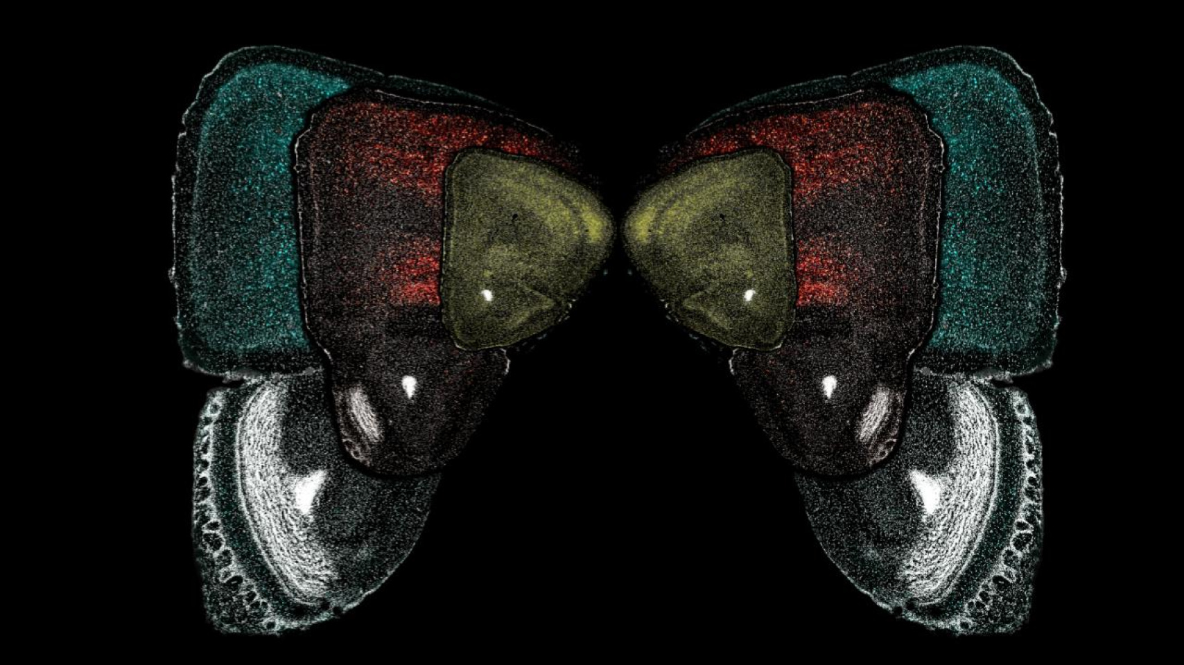 Primer premio del Concurso de Fotografía Neurocientífica. "El vuelo de la mente" de Natalia Varela Andrés.