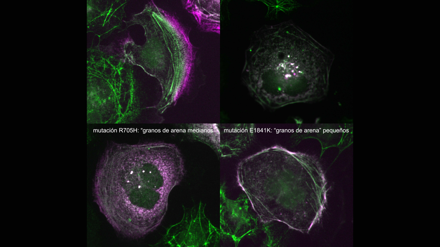 Ejemplo mutación R705H