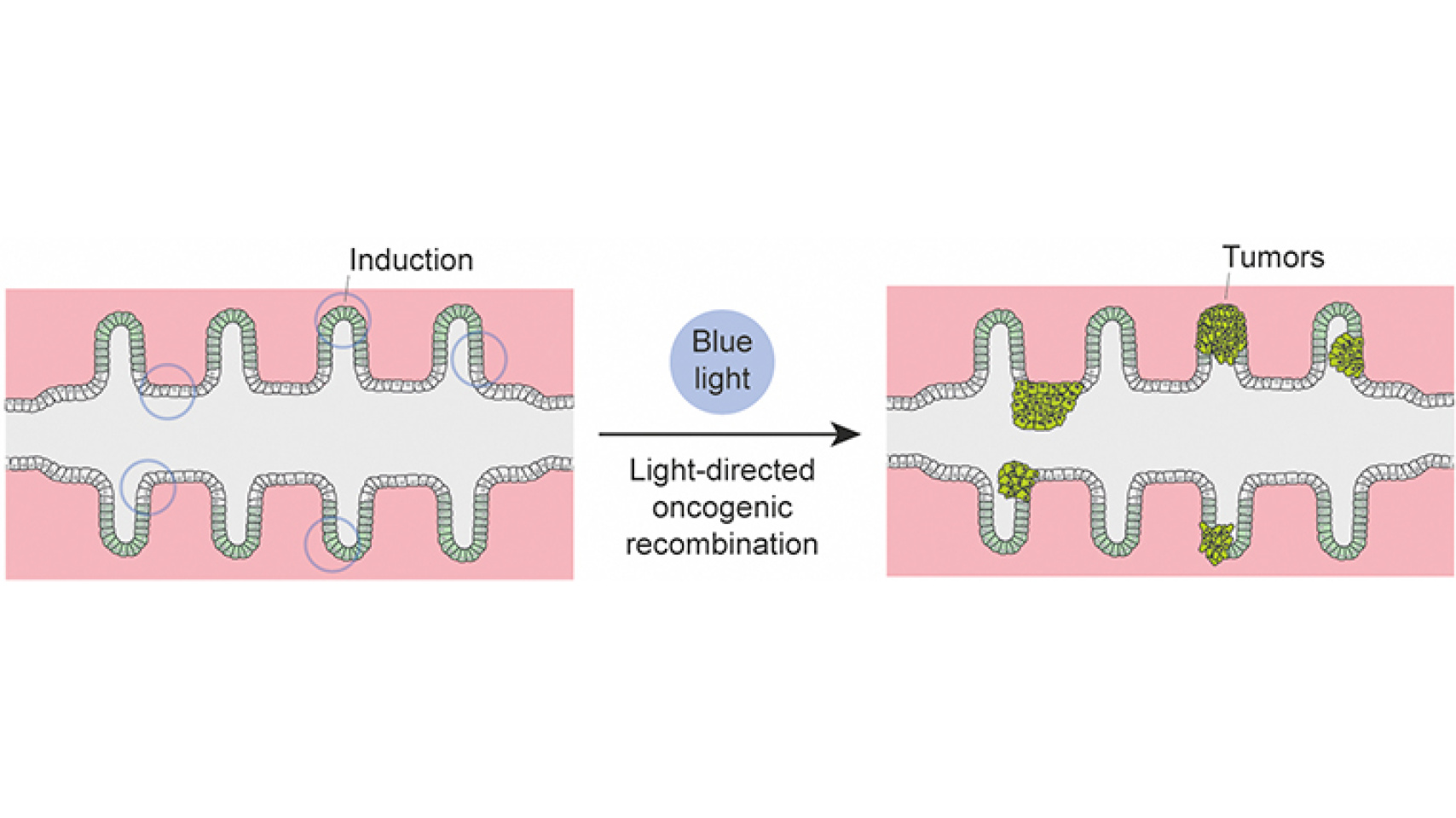 Mini-cólones bioartificiales para ver nacer el cáncer de colon en el laboratorio